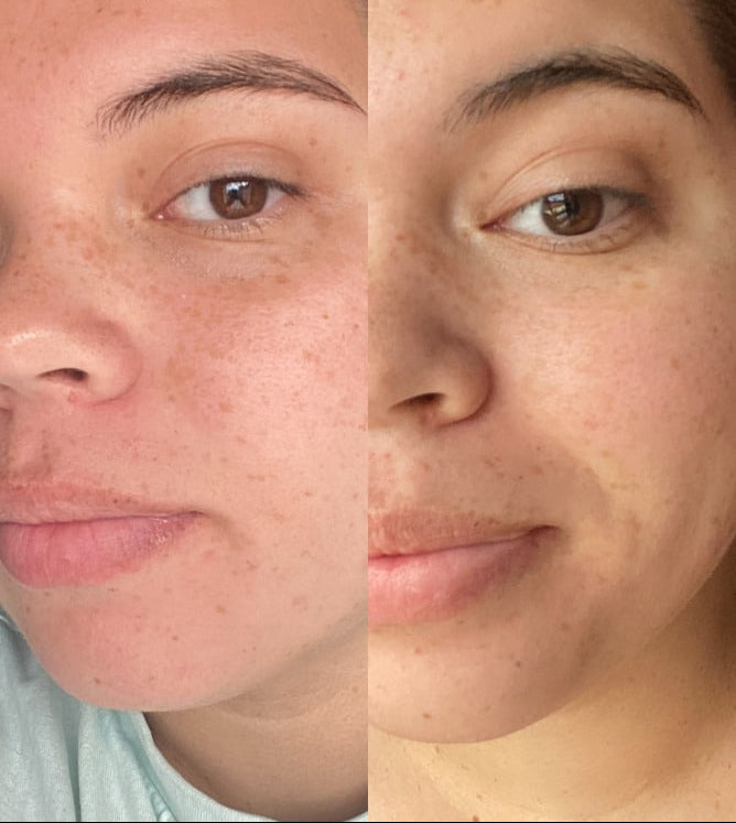 Routine peau sèche & terne