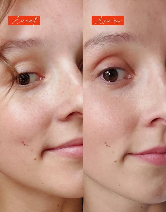 Routine peau sèche & terne