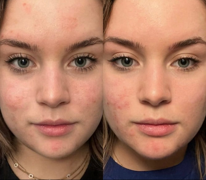 Lundi matin - Actif anti imperfections
