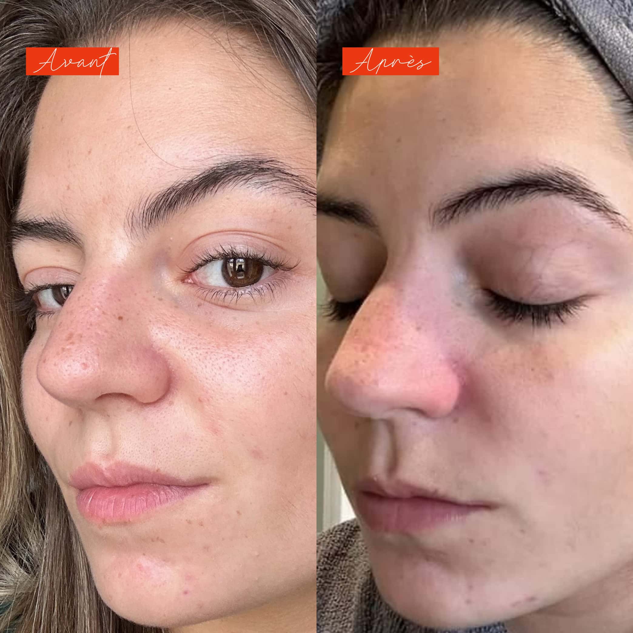 Sous le soleil - Actif anti-taches et éclat du teint