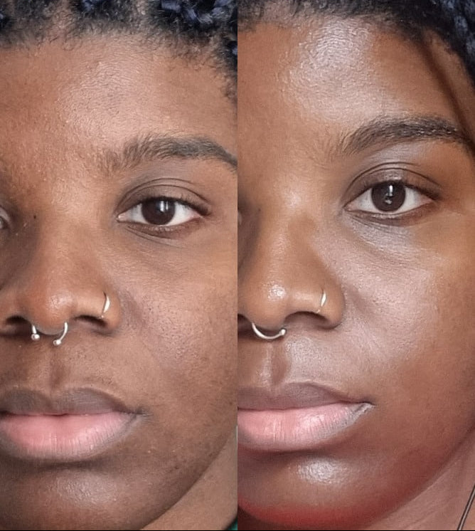 Routine peau à imperfections et taches